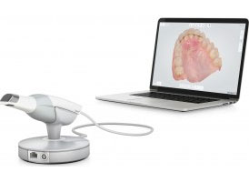 Ortodonția digitală sau sistemul CAD – CAM