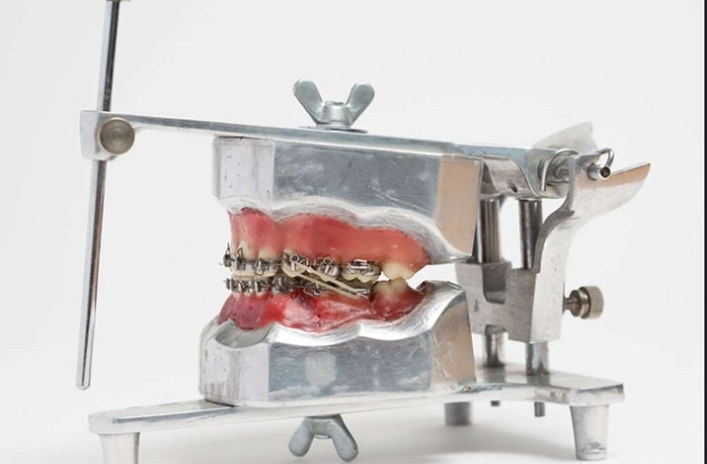 Evoluția ortodonției de-a lungul timpului, până în secolul XXI